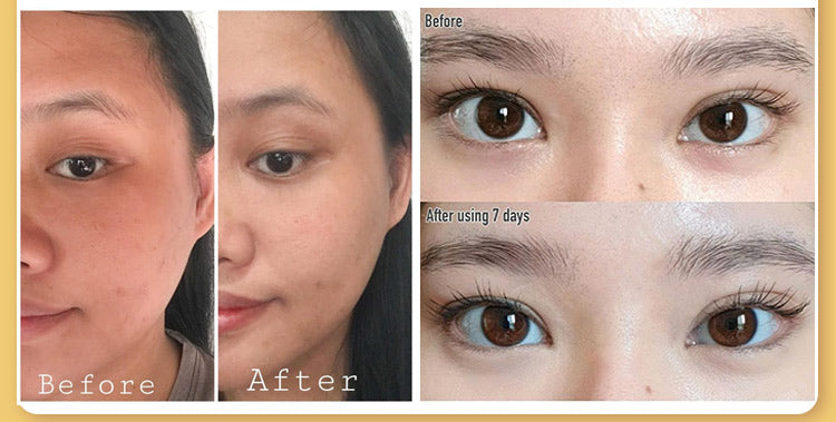 Demystifying Retinol for the Eyes: The Science-Backed Guide to Smoother, Younger-Looking Skin