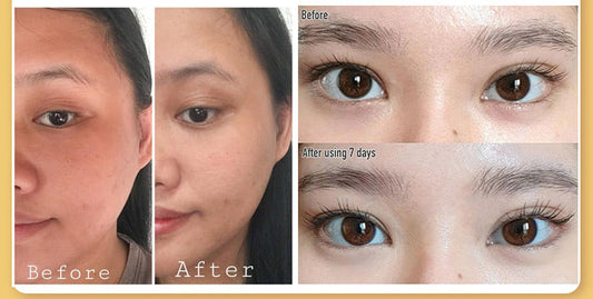 Demystifying Retinol for the Eyes: The Science-Backed Guide to Smoother, Younger-Looking Skin