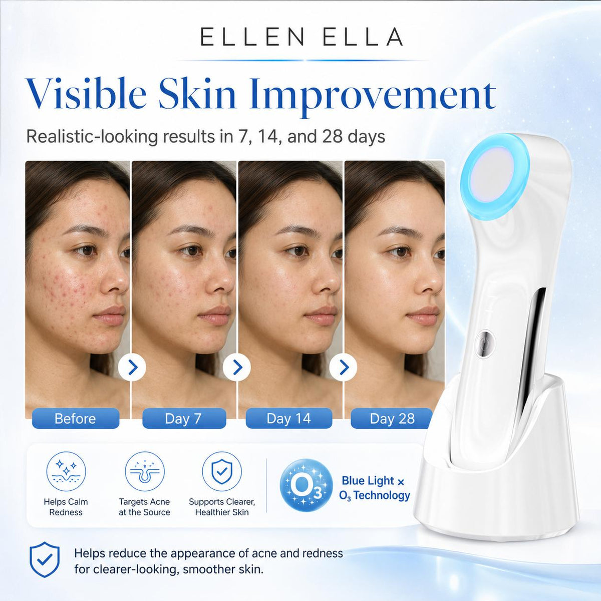 Ellen Ella OZÉRA™ Advanced Ozone Skin Renewal System