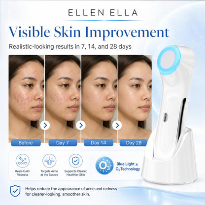 Ellen Ella OZÉRA™ Advanced Ozone Skin Renewal System