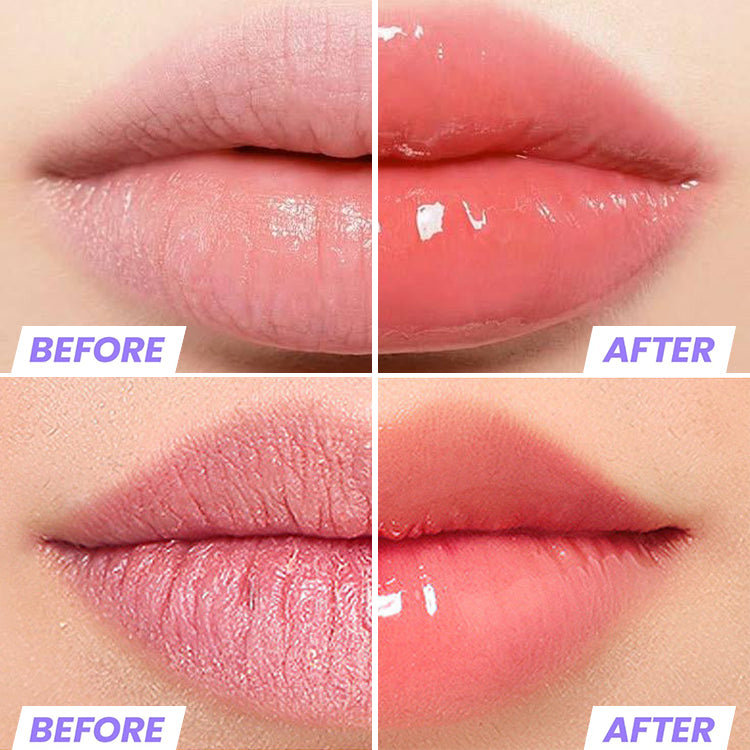 ALL IN 1 Lip Serum-24-Hour Long-Lasting Hydration-SPF15+-Nourishing, Moisturizing, Brightening, Reduces Lip Lines, Sun Protection