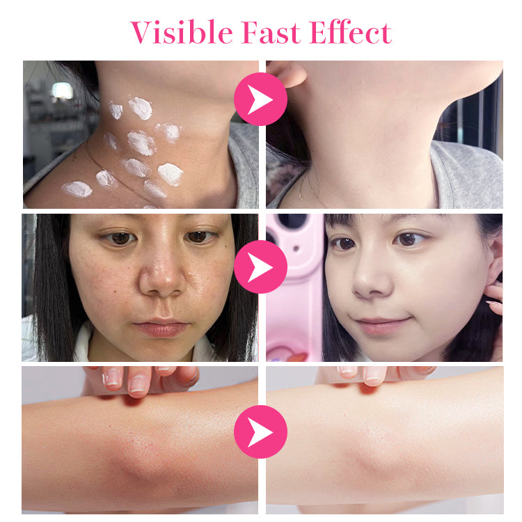 ELLEN ELLA Niacinamide Instant Brightening Combo