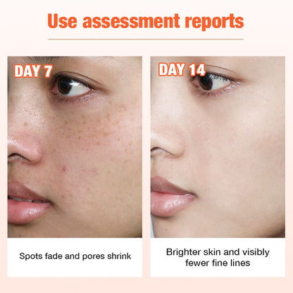 Vitamin C Whitening Cream for Face 30g Day Cream Freckles Dark Spot Remover Cream